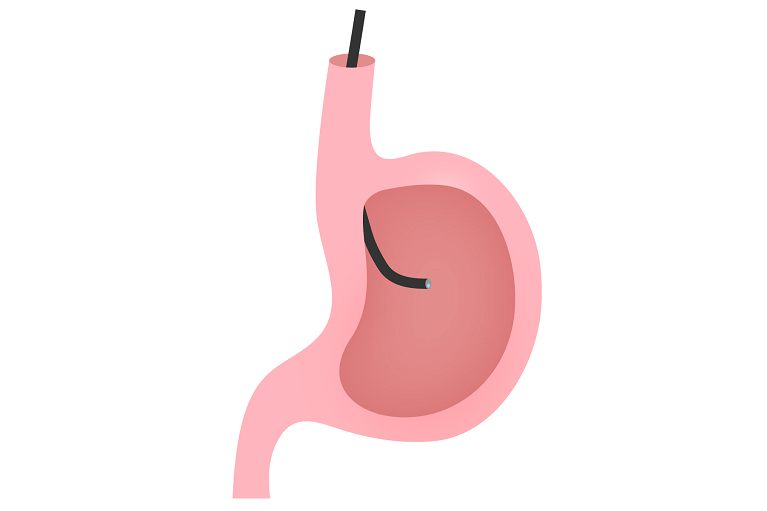 胃透視(バリウム検査)より胃カメラ(胃内視鏡検査)をおすすめする理由は？